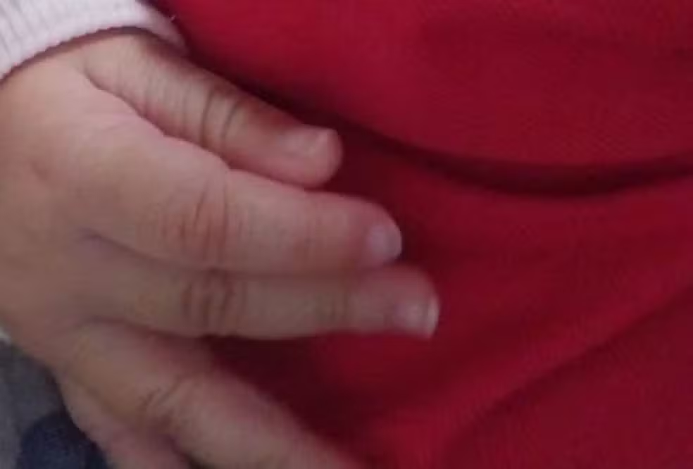 Bebê de 7 meses sofre lesões graves